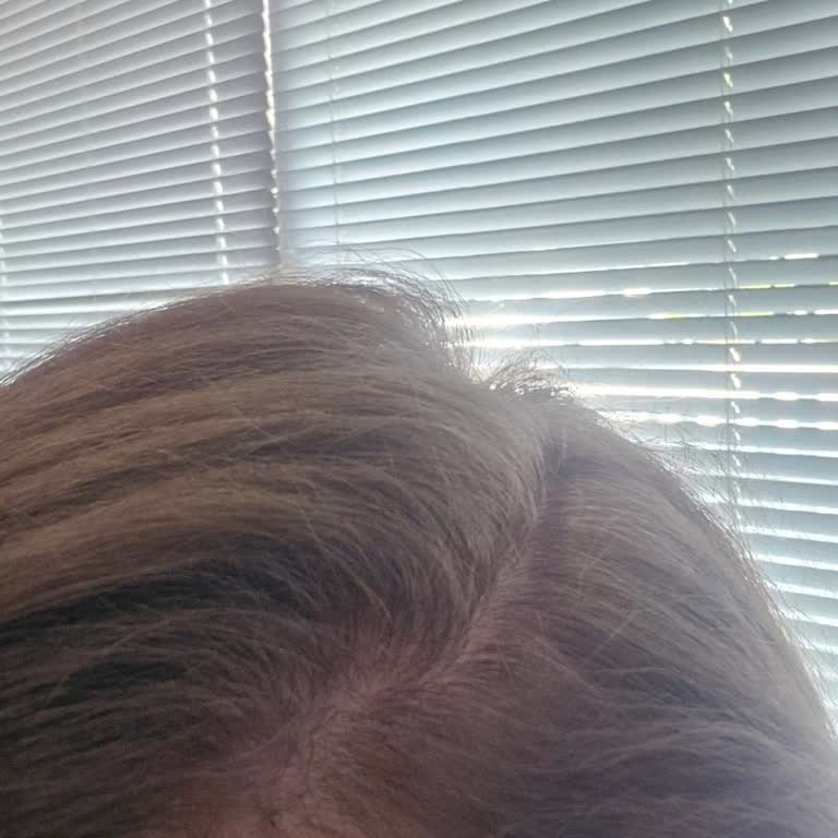 Loreal Paris Saç Boyası Saç Rengimi Beklenmedik Şekilde Değiştirdi