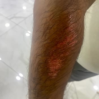 Skyjet Nitro Bisikletin Güvenlik Sorunu Ve Yetersiz Müşteri Hizmeti