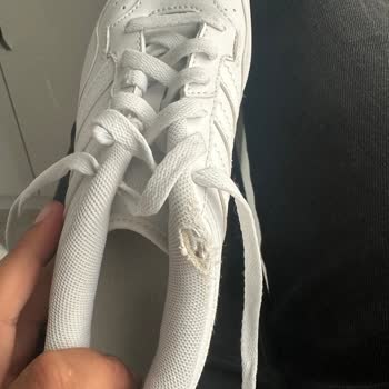 Adidas Ayakkabıda Erken Yırtılma Ve Hayal Kırıklığı