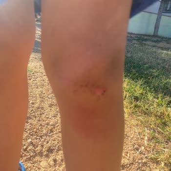 Çocuk Parkındaki Bakımsızlık Ve Güvenlik Sorunları