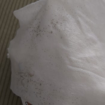 Islak Mendilde Yabancı Madde Nedeniyle Bebeğimin Sağlığı Risk Altında