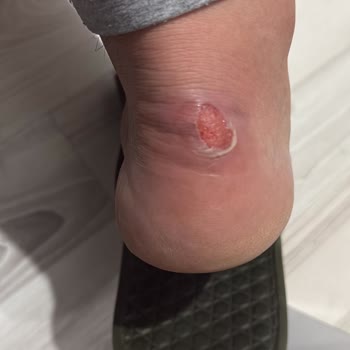 FLO Mağazasında Değişim Sırasında Fiyat Farkı Mağduriyeti