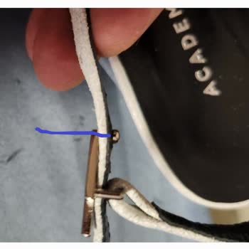 Ayakkabı Arka Tokası Ayağımı Yaraladı, İnceleme Sonucu Olumsuz