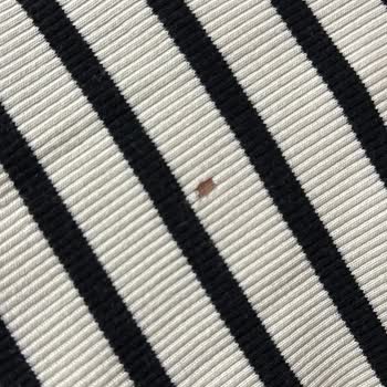 Beko Çamaşır Makinesi Eşyaları Yırtıyor, Servis Çözüm Sunmuyor