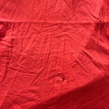 Beko Çamaşır Makinesi Eşyaları Yırtıyor, Servis Çözüm Sunmuyor