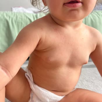 Klamoks Antibiyotik Bebeğimde Ciddi Alerjik Reaksiyona Yol Açtı