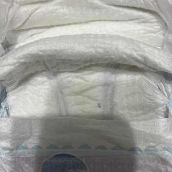 Bebek Bezinde Yabancı Madde Sorunu