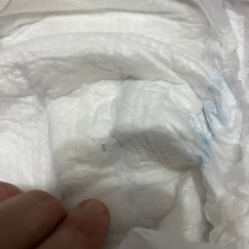 Bebek Bezinde Yabancı Madde Sorunu