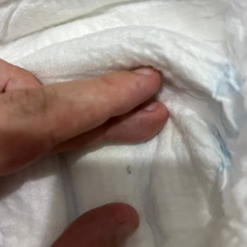 Bebek Bezinde Yabancı Madde Sorunu