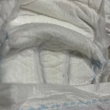 Bebek Bezinde Yabancı Madde Sorunu