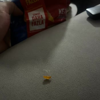 Ruffles Ketçaplı Cipsin İçinden Yabancı Madde Çıkması