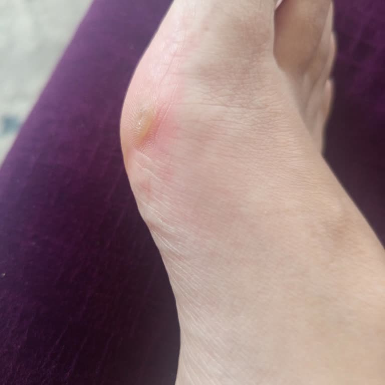 Sporthink Puma Ayakkabı Ayağımı Yaraladı, İade Talebim Reddedildi