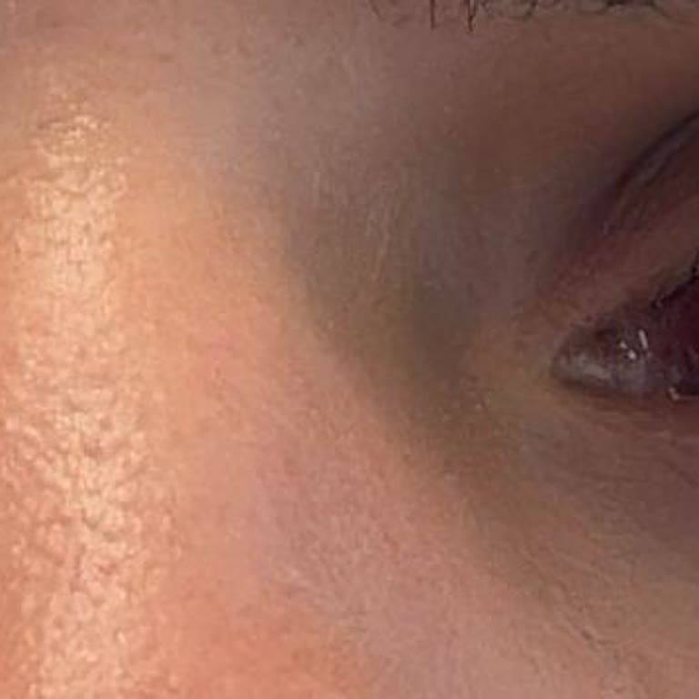 Kısa Süren Muayene İçin Yüksek Ücret Alındı