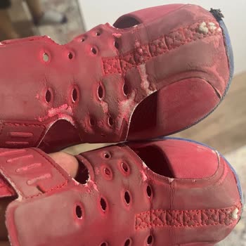 Çocuk Sandaleti Kısa Sürede Deforme Oldu İade Reddedildi