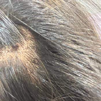 Paris Kuaför'de Saçım Yandı, Paramı İade Etmediler!