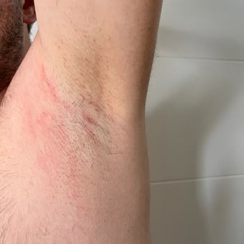 İade Edilmeyen Ürün Yüzüme Ve Cildime Zarar Verdi