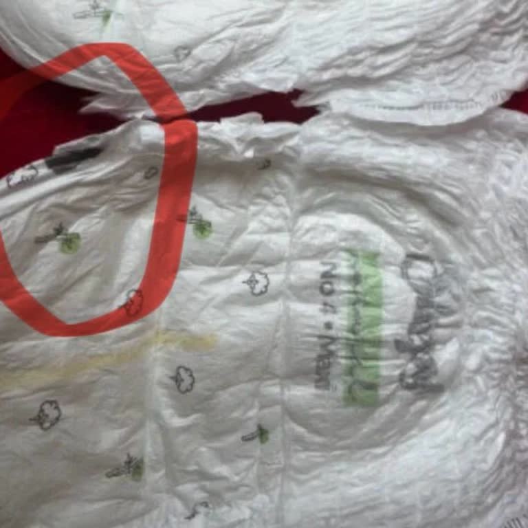 Sleepy Bebek Bezinde Siyah Çizgi Sorunu Ve Cilt Tahrişi