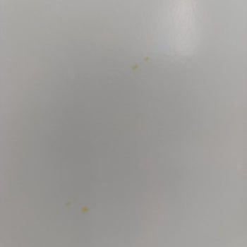 Bellona Loretto Yemek Odası Takımında Sararma Ve Yetersiz Servis İncelemesi