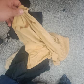 Havayolu Uçuşunda Bagaj Hasarı ve Destek Sorunu