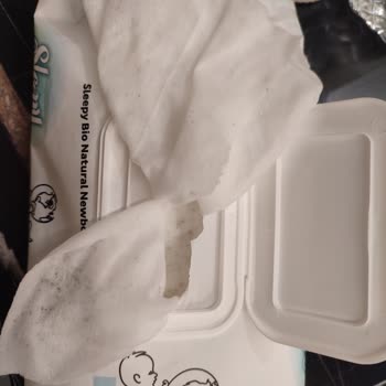 Küflü Islak Mendil Bebeğimin Cildinde Sorun Yarattı