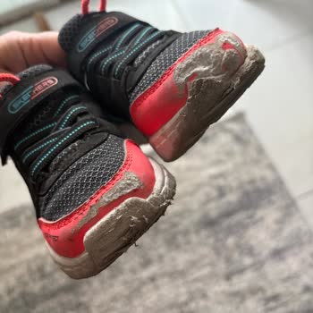 Kısa Sürede Deforme Olan Skechers Çocuk Ayakkabısı İçin İade Talebi