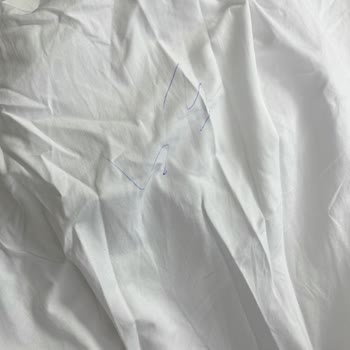 Üründeki Leke Sorunu Ve Müşteri Hizmetlerine Ulaşılamıyor