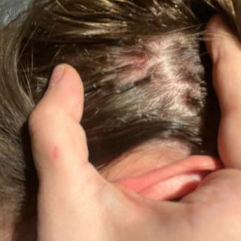 Toprak Şeker Kuaför Saç Kaynak İşlemi Sonrası Büyük Hayal Kırıklığı