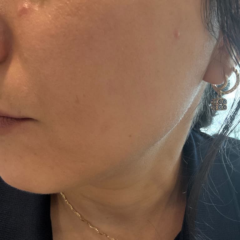 Cilt Bakımı Sonrası İade Talebim Reddedildi Müşteri Hizmetleri İlgisiz Kaldı