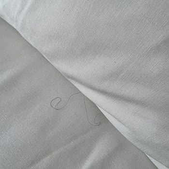 Hijyen Sorunları Nedeniyle Otelde Kalamadan Paramı Geri Alamadım