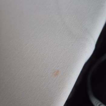 Hijyen Sorunları Nedeniyle Otelde Kalamadan Paramı Geri Alamadım