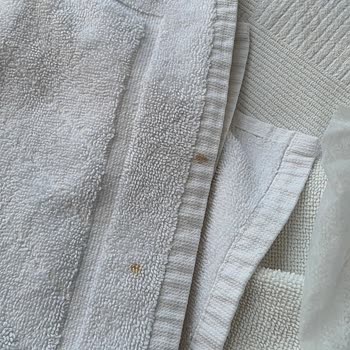 Hijyen Sorunları Nedeniyle Otelde Kalamadan Paramı Geri Alamadım