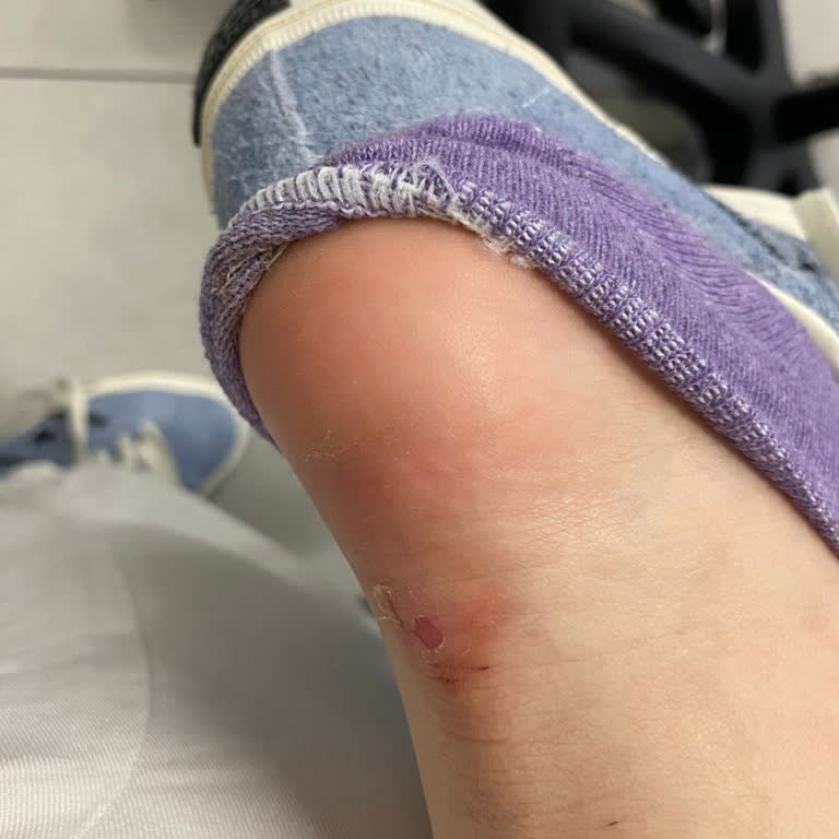 Ayakkabı Rahatsızlığına Çözüm Sunulmaması Müşteri Memnuniyetini Zedeliyor