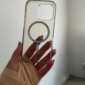 Sararmaya Karşı Dayanıklı Denilen Spigen Kılıf 5 Ayda Sarardı, Garanti Desteği Hayal Kırıklığı