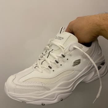 Skechers Ayakkabıda Renk Değişimi Ve Yetersiz Müşteri Hizmeti