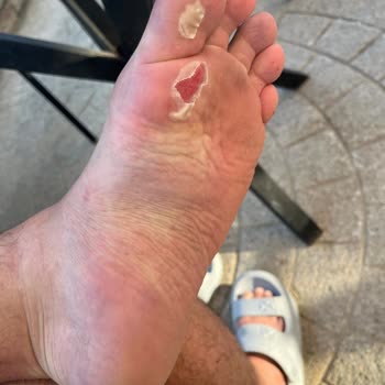 Tatilimizde Oda Sorunu Ve Beton Sahada Yaşanan Yaralanma İle Hayal Kırıklığı