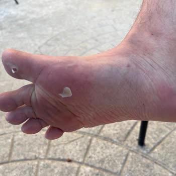 Tatilimizde Oda Sorunu Ve Beton Sahada Yaşanan Yaralanma İle Hayal Kırıklığı