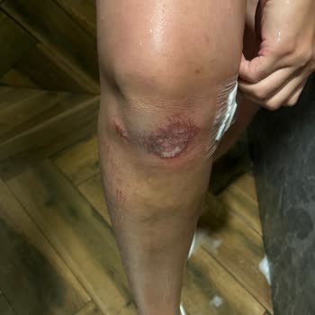 Tatilimizde Oda Sorunu Ve Beton Sahada Yaşanan Yaralanma İle Hayal Kırıklığı