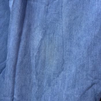 Aldığım Üründeki Leke İçin Kullanıcı Hatası Denilerek Mağdur Edildim