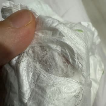 Sleepy Bebek Bezinde Topaklanmış Yabancı Madde Endişesi