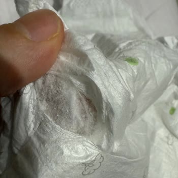 Sleepy Bebek Bezinde Topaklanmış Yabancı Madde Endişesi