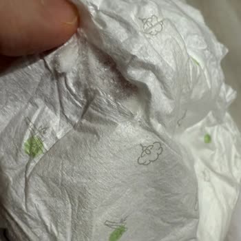 Sleepy Bebek Bezinde Topaklanmış Yabancı Madde Endişesi