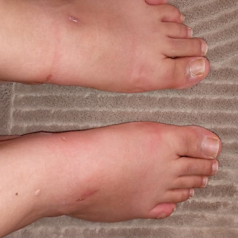 FLO'dan Aldığım Terlik Ayağımı Yaraladı, İade Talebim Reddedildi