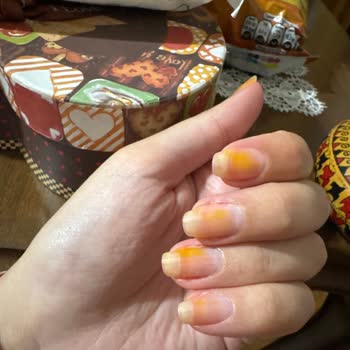 Pastel Oje Tırnaklarımda Turunculaşmaya Sebep Oldu