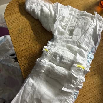 Molfix Bebek Bezi Çocuklarımda Alerji Ve Pişik Yaptı, Mağdur Olduk