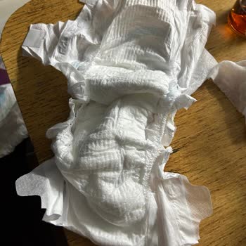 Molfix Bebek Bezi Çocuklarımda Alerji Ve Pişik Yaptı, Mağdur Olduk