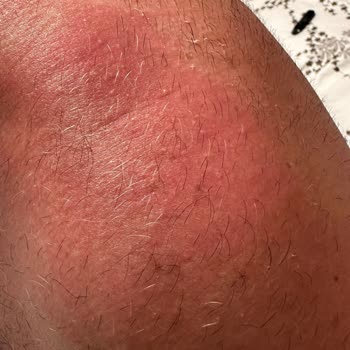 Ecowell Yüksek Faktörlü Güneş Kremi Beklenen Korumayı Sağlamadı