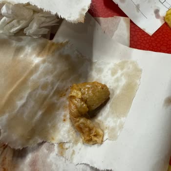 Dürümden Çiğ Tavuk Çıkması Ve Yetersiz Müşteri İlgisi