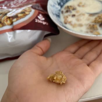 Kellogg’s Granola Ürününde Hijyen Sorunu Ve Sağlık Riski