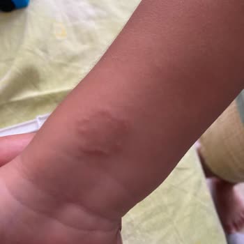 İnnovia Site Yönetimi Sitede Yaygın Böcek Sorunu Sağlığımızı Tehdit Ediyor