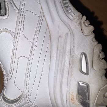 Skechers Ayakkabıda Kısa Sürede Ezilme Ve Batma, İnceleme Sonucu Hayal Kırıklığı